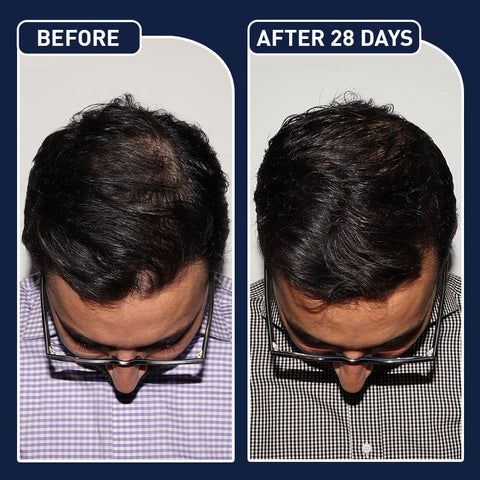 Saudi Deal™ FEG Plus Hair Growth Treatment Oil Hair Spray,Serum,Hair Enhancing Formula