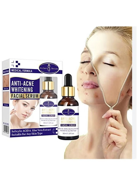 Saudi Deal™ Anti-Acne Whitening Facial Serum